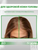 Пилинг для кожи головы с салициловой кислотой EDEN Cosmetics, 100 мл фото 4